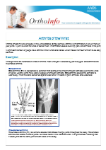 Wrist Archives Gold Coast Upper Limb Centre